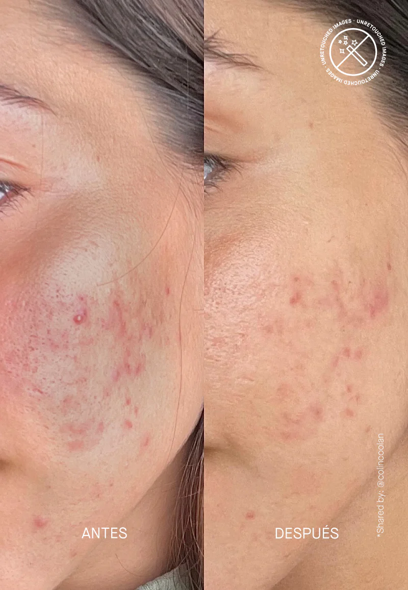 Imagen del producto 10